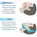 Ilustração comparando boca aberta e fechada com faixa mandibular