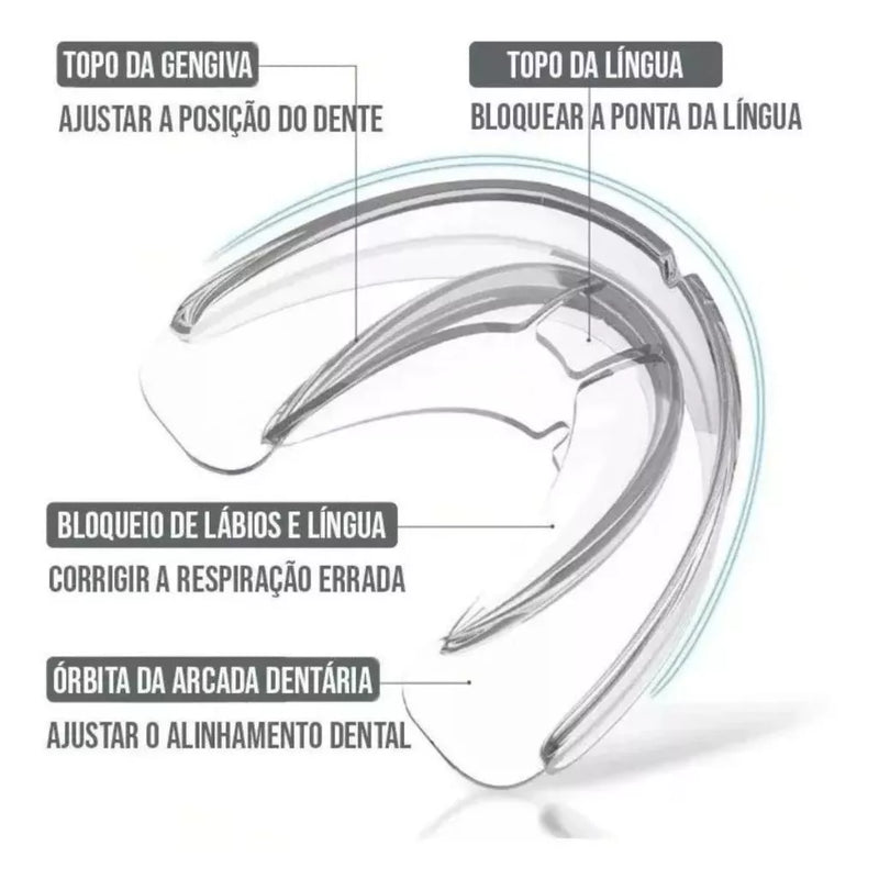 Esquema do protetor bucal NightFlow com áreas da boca identificadas